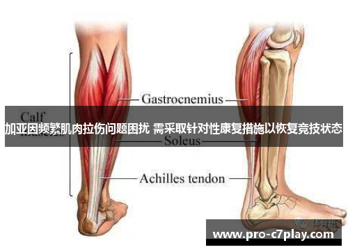 加亚因频繁肌肉拉伤问题困扰 需采取针对性康复措施以恢复竞技状态 加亚因频繁肌肉拉伤问题困扰 需采取针对性康复措施以恢复竞技状态